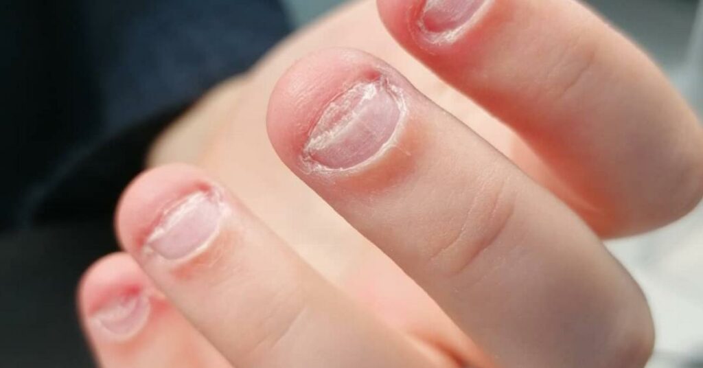 Гризти нігті шкідливо